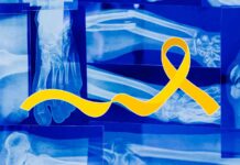 E' una nuova speranza per i pazienti affetti da osteosarcoma quella presentata dai ricercatori, che utilizzano il gallio contro il cancro.