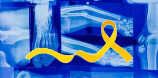 E' una nuova speranza per i pazienti affetti da osteosarcoma quella presentata dai ricercatori, che utilizzano il gallio contro il cancro.